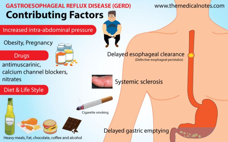 causes-of-gastroesophageal-reflux-disease-the-medical-notes